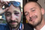 Brooklyn Man Who Got Attacked For Looking Like Shia LaBeouf Gets A Phone Call From LaBeouf Himself